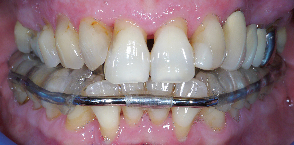 Das Ziel sicher erreichen