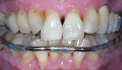 Das Ziel sicher erreichen