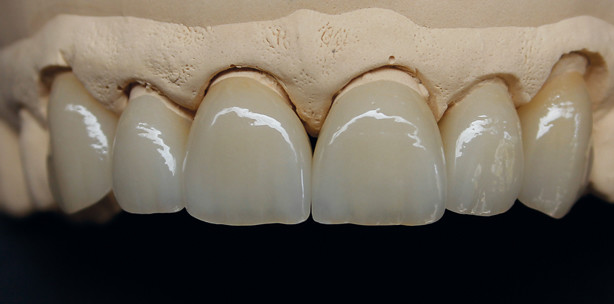 Wiederherstellung der rot-weißen Ästhetik