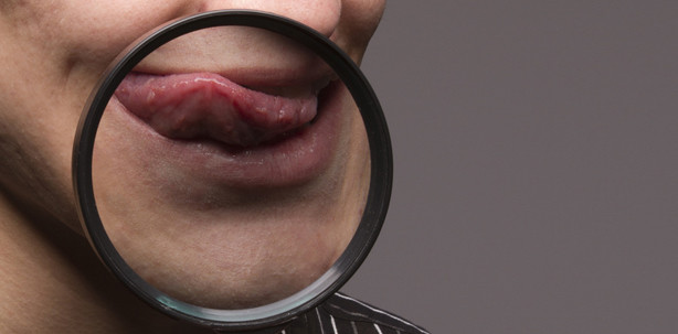 Hoffnung in der Zungenkrebs-Therapie