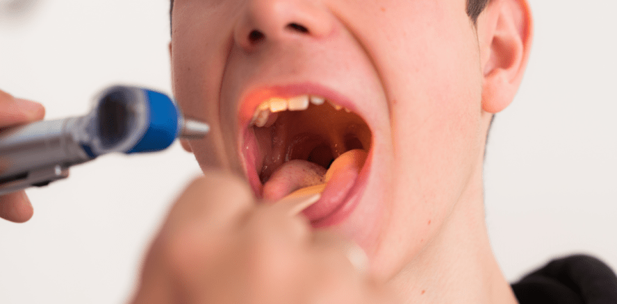 Neue Studie über Zungenkrebs: Tumordicke entscheidend