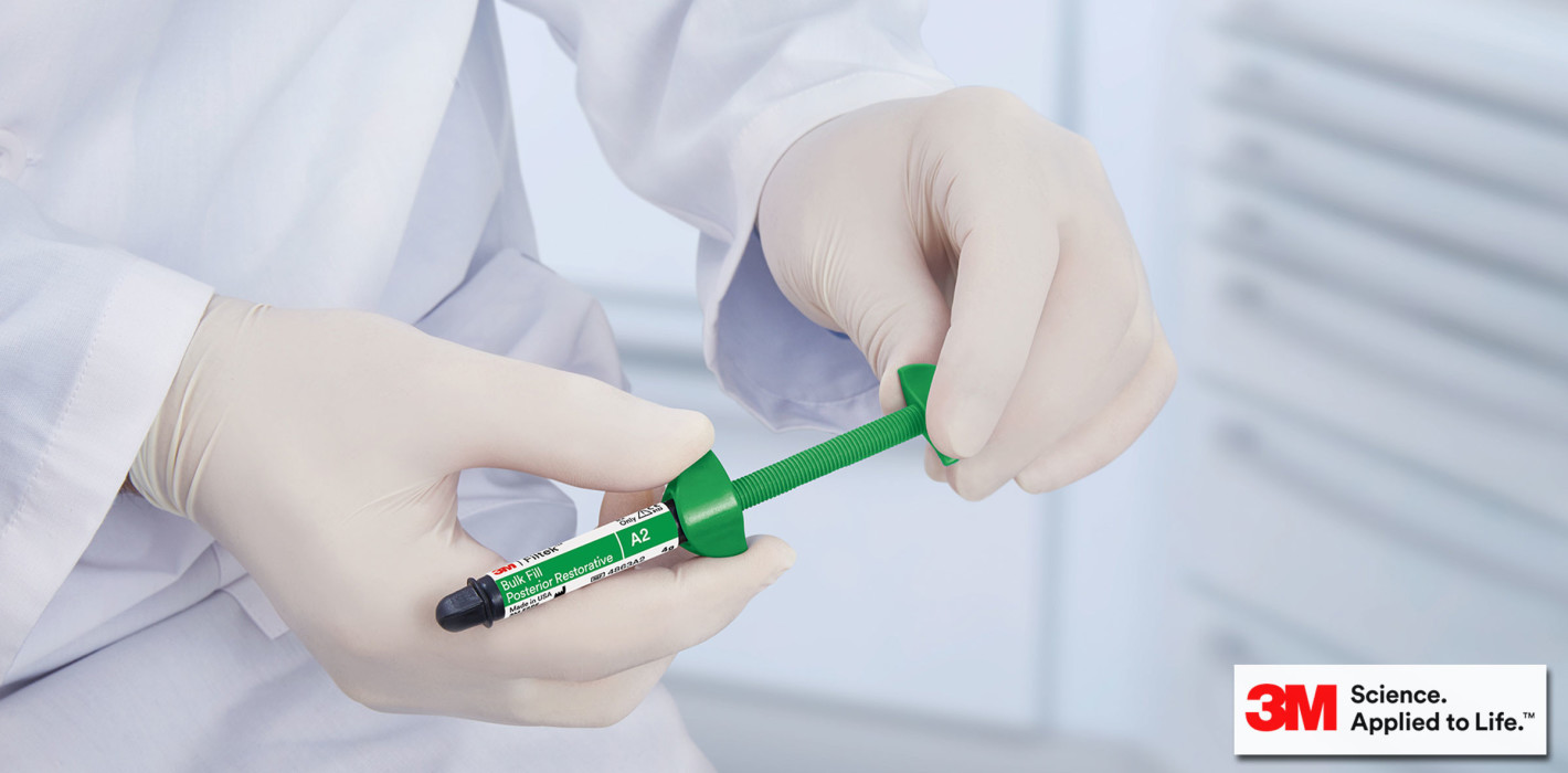Bulk-Fill-Komposit als Amalgam-Alternative?