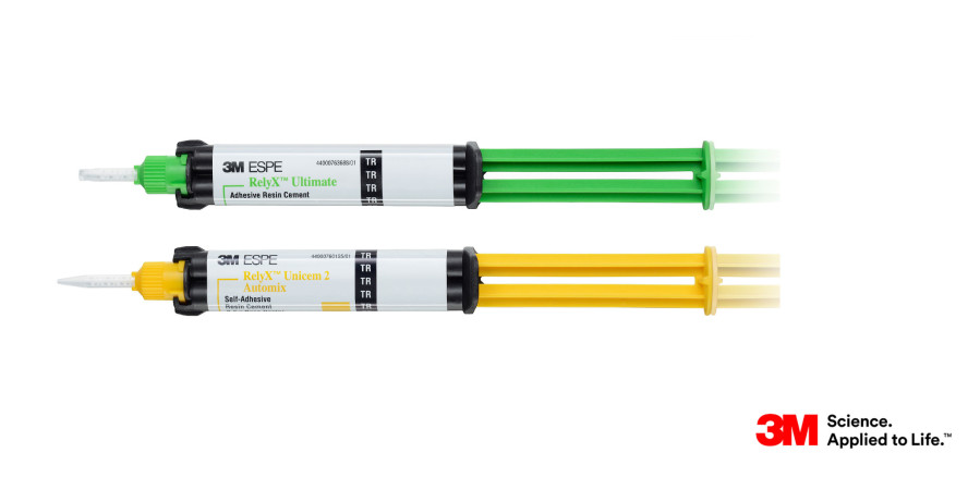 Befestigungsmaterialien im Test: Klinische Ergebnisse nach 5 und 15 Jahren