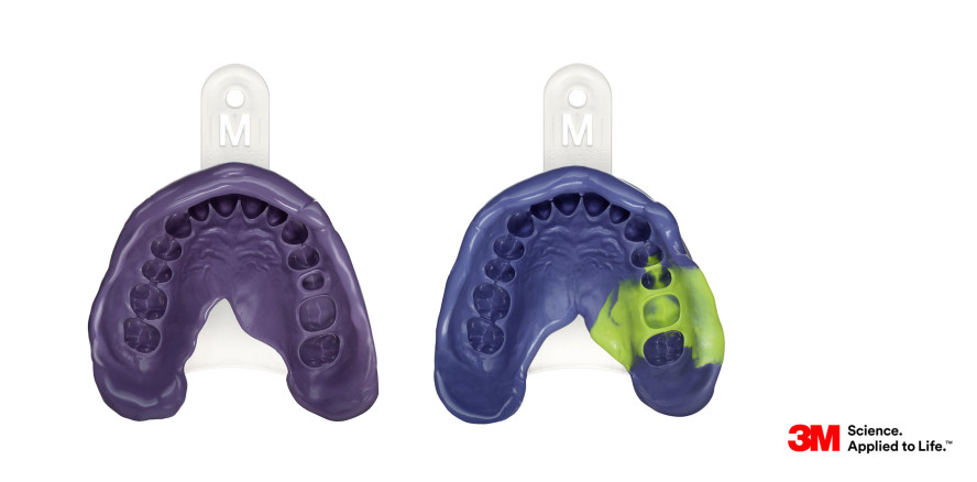 97 Prozent empfehlen neues 3M Abformmaterial weiter