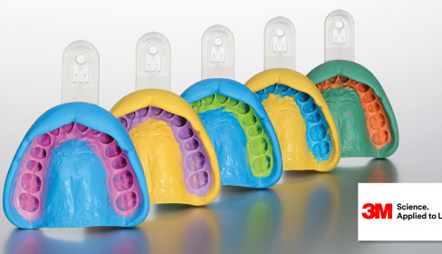 Слепок зубов. Альгинатный слепок зубов. Силиконовый слепок. Слепки зубов для протезирования