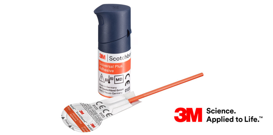 Universaladhäsiv: Das Original – jetzt noch besser