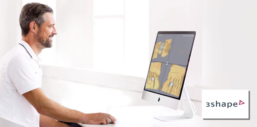 3Shape Automate: Neue Wege zum digitalen Design