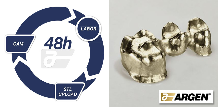 Argen Digital fertigt Goldgerüste mit Argistar 570 in 48 Stunden