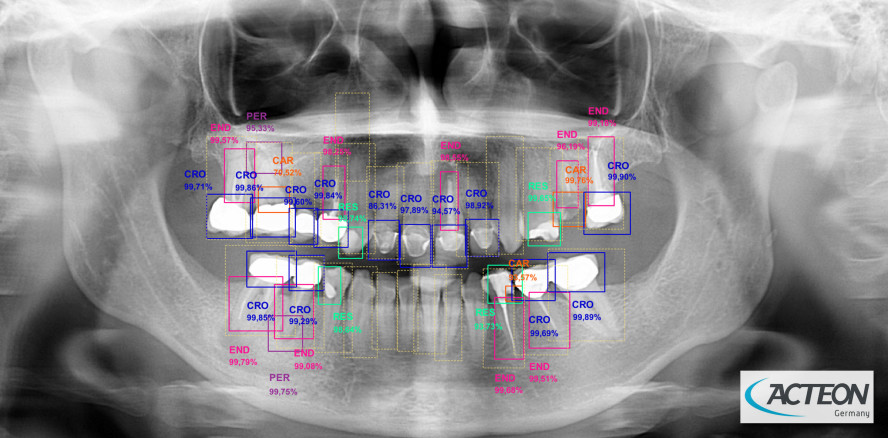 Künstliche Intelligenz in der 2D-Bildgebung