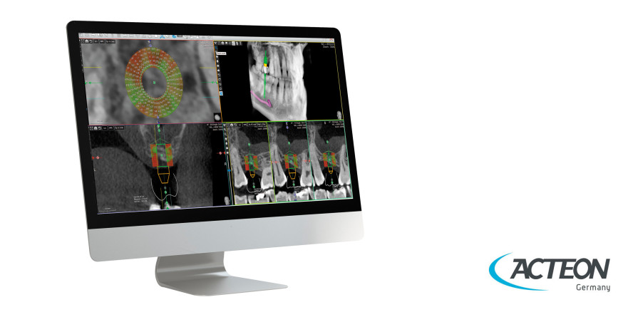 Imaging Software: Herzstück der Bildgebung
