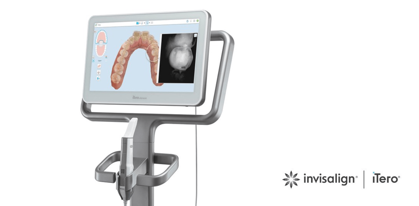 Neue iTero Workflow 2.0 Software mit automatischer Upload-Funktion