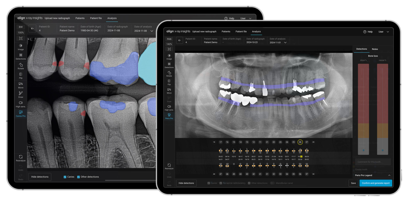Anwender über Align X-ray Insights von Align Technology