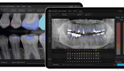 Anwender über Align X-ray Insights von Align Technology