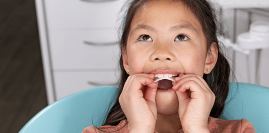 Invisalign® Palatal Expander System ab sofort erhältlich