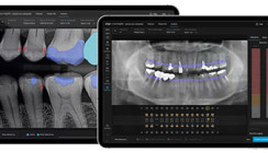 Align X-ray Insights