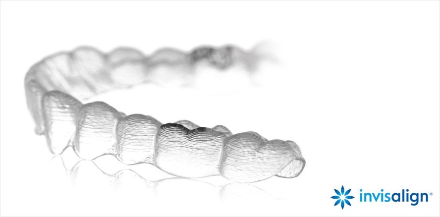 Zahnbegradigung: Selbstbewusst Lächeln mit Invisalign® Go