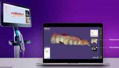 Align stellt die neueste Version des iTero – exocad Connector vor
