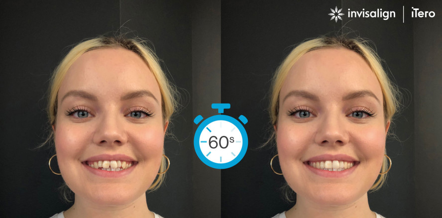 SmileView – Sichtbares Ergebnis in Sekundenschnelle