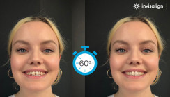 SmileView – Sichtbares Ergebnis in Sekundenschnelle