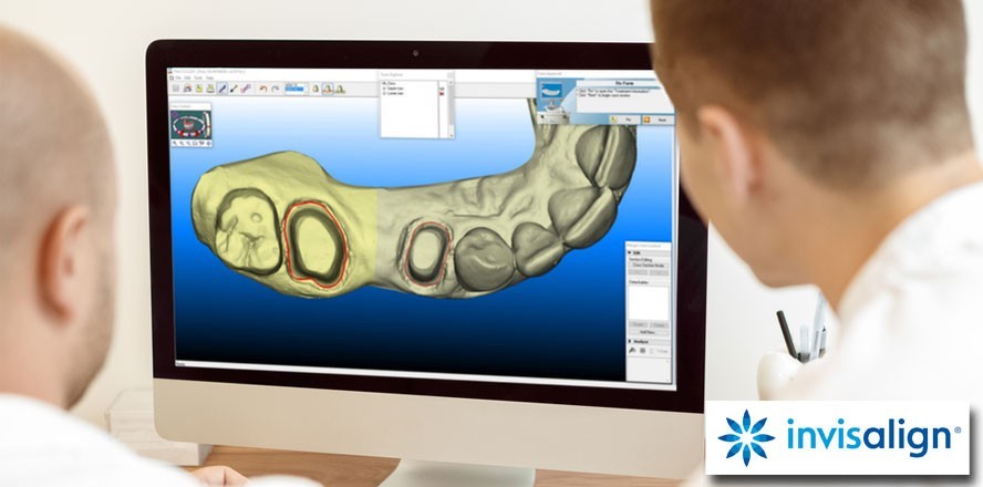 Digitale Abformung mit breitem Anwendungsspektrum