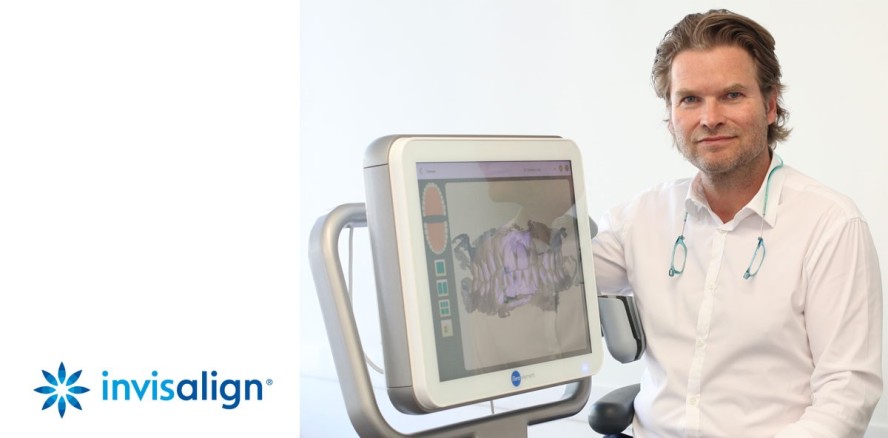 Über den ersten Eindruck hinaus: Verborgene Vorteile der digitalen Abformung