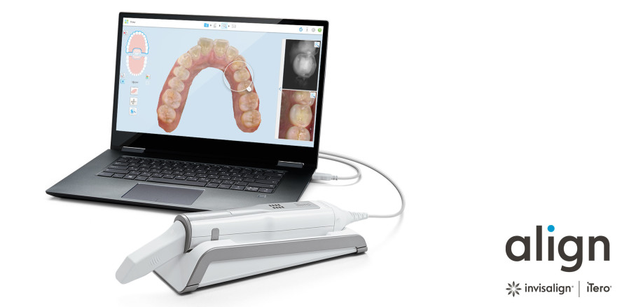 Komplett digitaler Workflow für präventive und restaurative Zahnmedizin