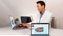 Align kündigt iTero™ Intraoral­scanner Produktinnovationen an