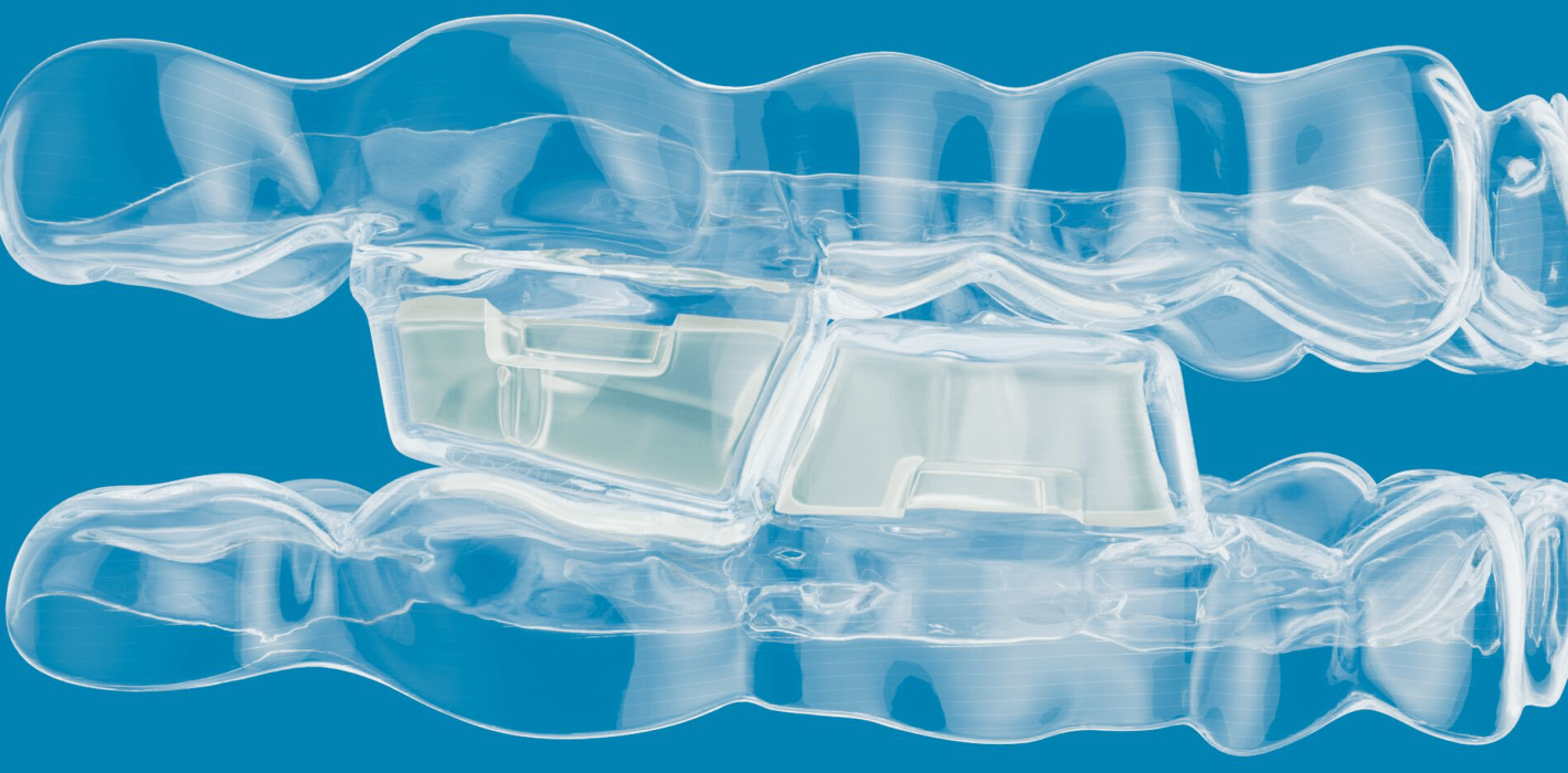 Align Technology kündigt die Verfügbarkeit eines neuen Invisalign® Systems an