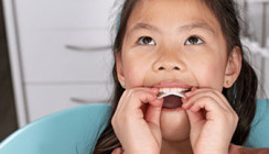 Invisalign® Palatal Expander System