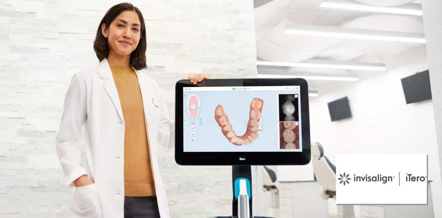 Studie bestätigt signifikante Vorteile des iTero 5D Bildgebungssystem