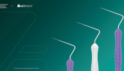 Gezielte Zugangserweiterung unter optimaler Sichtkontrolle: Der KEYDENT My Opener