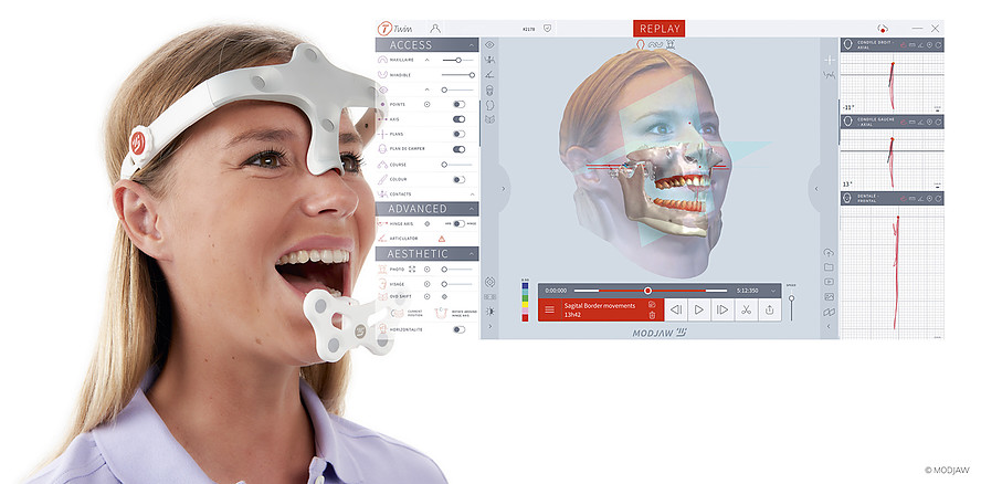 MODJAW Funktionsscanner: Dynamische Kieferbewegungen präzise erfassen