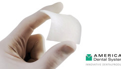 Xenogene Bone Lamina – das Multitalent für die Augmentation