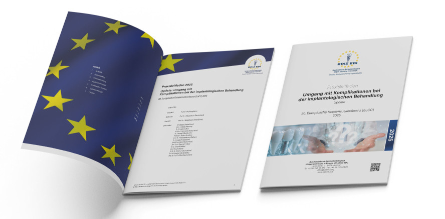 Praxisleitfaden Komplikationen bei der Implantatbehandlung