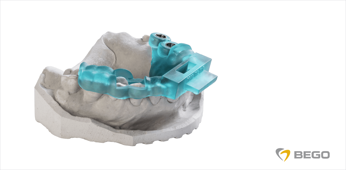 3Shape qualifiziert BEGO Varseo als validierten 3D-Drucker