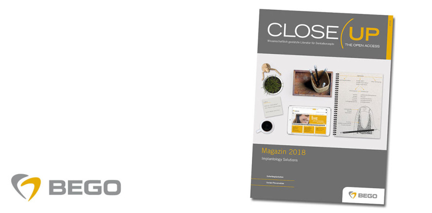 BEGO Implant Systems veröffentlicht neues Close Up Magazin 2018