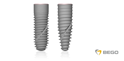 Seit 1. September verfügbar: Das neue Conical Connection-System von BEGO