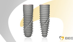BEGO stellt belastbare Daten zur Implantat-Abutment-Verbindung bereit