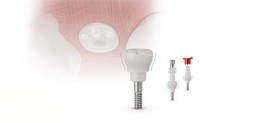 Gingividual® Concept Basic