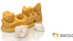Weltneuheit: BEGO präsentiert 3D-Druck-Hybridmaterial