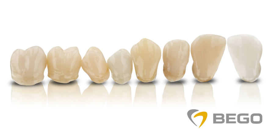 BEGO stärkt seine Pionierrolle in 3D-Druckmaterialien