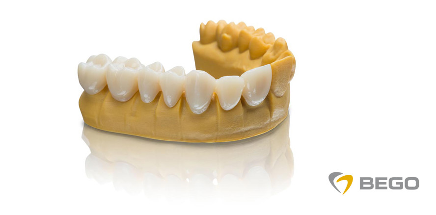 BEGO 3D-Druck-Materialien für den Asiga* MAX UV 3D-Drucker erhältlich