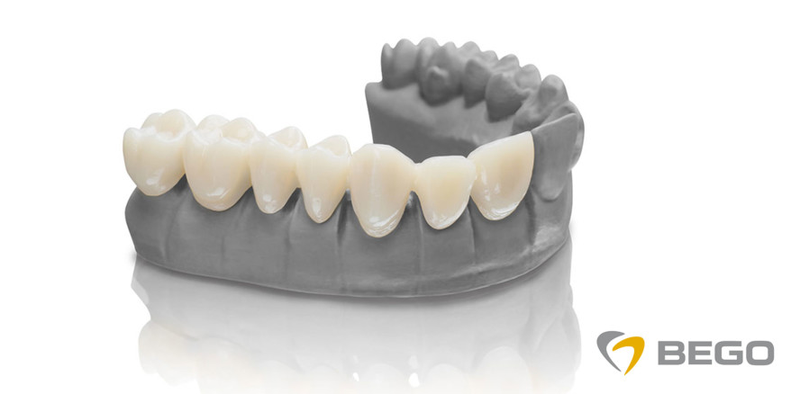 VarseoSmile 3D-Druck-Materialien jetzt auch in BEGO Bleach erhältlich