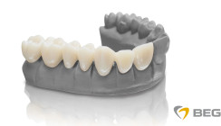 VarseoSmile 3D-Druck-Materialien jetzt auch in BEGO Bleach erhältlich