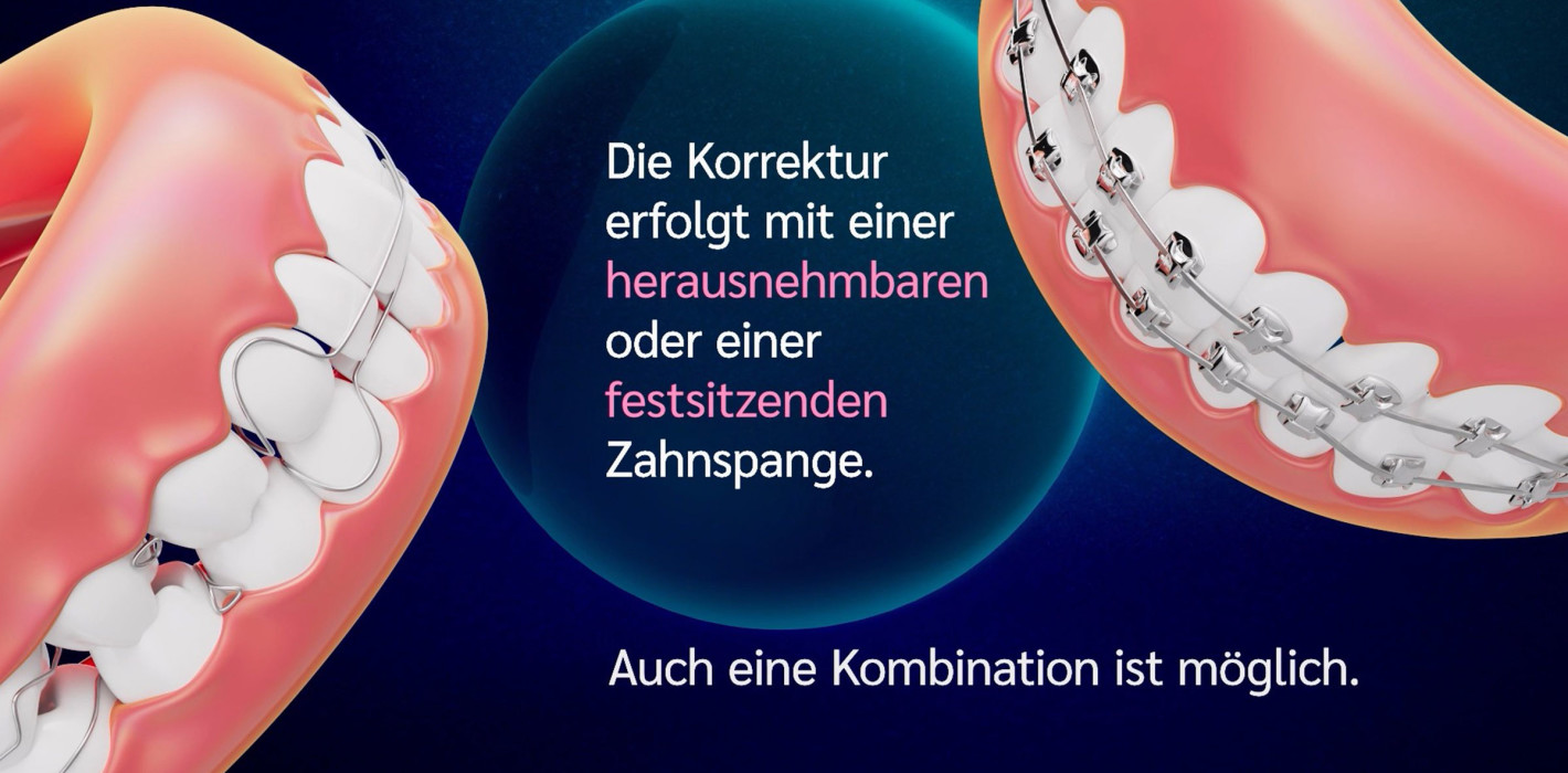 Neuer Film zur KFO … und welche BLZK-Patienteninfos es noch zum Thema gibt