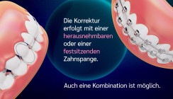 Neuer Film zur KFO … und welche BLZK-Patienteninfos es noch zum Thema gibt