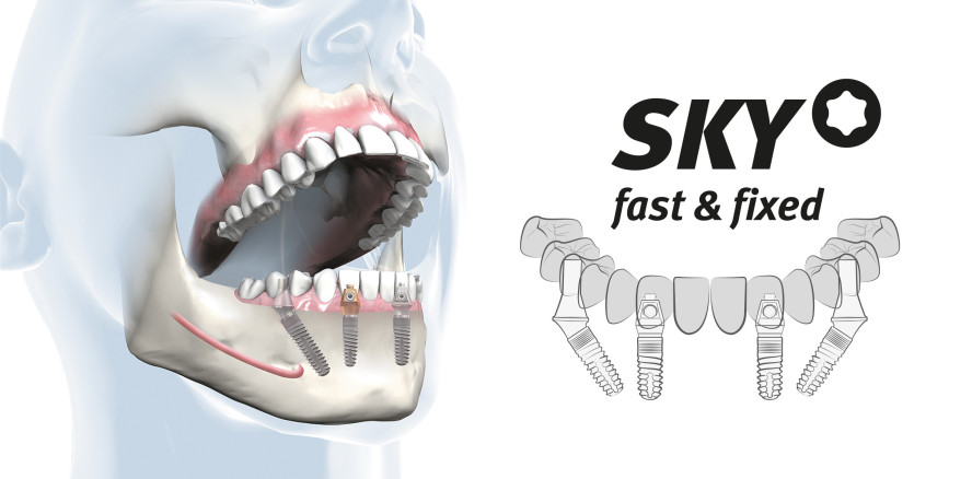 15 Jahre SKY fast & fixed: Die Erfolgsgeschichte