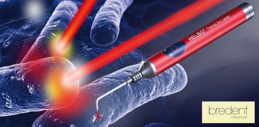 Photodynamik bei Parodontitis- und Periimplantitistherapie