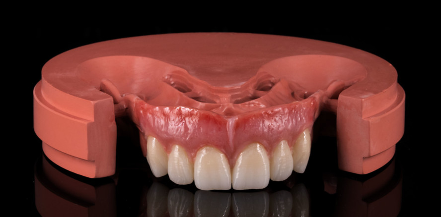 bredent entwickelt den Hochleistungs&shy;kunststoff BioHPP weiter