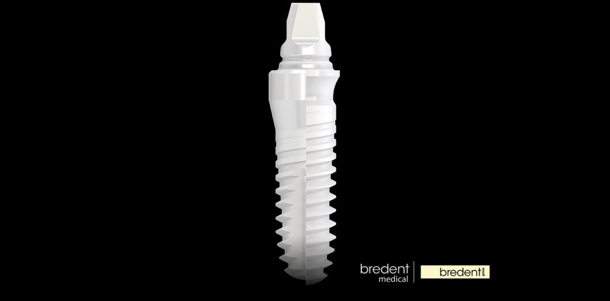 bredent medical garantiert Versorgungssicherheit mit Zirkonimplantaten